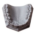 Orthodontic-Stone